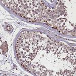 FAM195B Antibody in Immunohistochemistry (Paraffin) (IHC (P))