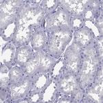 IL17REL Polyclonal Antibody