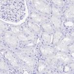 REG1A Antibody in Immunohistochemistry (Paraffin) (IHC (P))