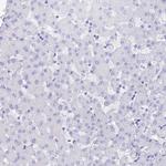 REG1A Antibody in Immunohistochemistry (Paraffin) (IHC (P))