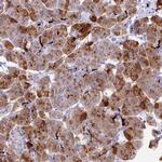 REG1A Antibody in Immunohistochemistry (Paraffin) (IHC (P))