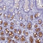 REG1A Antibody in Immunohistochemistry (Paraffin) (IHC (P))