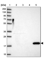 REG1A Antibody in Western Blot (WB)