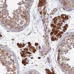 OR14J1 Polyclonal Antibody