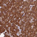 TCP-1 zeta Polyclonal Antibody