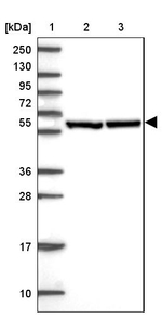 TCP-1 zeta Antibody in Western Blot (WB)