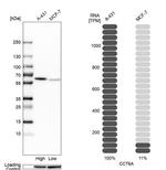 TCP-1 zeta Antibody in Western Blot (WB)