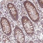 MINT3 Antibody in Immunohistochemistry (Paraffin) (IHC (P))