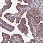 MINT3 Polyclonal Antibody