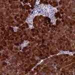 REG1A Polyclonal Antibody