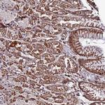AMER3 Antibody in Immunohistochemistry (Paraffin) (IHC (P))