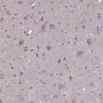 OR2W3 Antibody in Immunohistochemistry (Paraffin) (IHC (P))