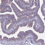 OR2W3 Antibody in Immunohistochemistry (Paraffin) (IHC (P))