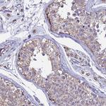 OR2W3 Polyclonal Antibody