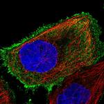 OR8S1 Polyclonal Antibody