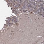 CNTD2 Antibody in Immunohistochemistry (Paraffin) (IHC (P))