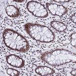 SNRPA1 Antibody in Immunohistochemistry (Paraffin) (IHC (P))