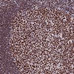 SNRPA1 Antibody in Immunohistochemistry (Paraffin) (IHC (P))