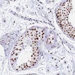 SNRPA1 Antibody in Immunohistochemistry (Paraffin) (IHC (P))