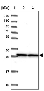 SNRPA1 Antibody in Western Blot (WB)