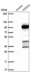 CCDC9 Antibody in Western Blot (WB)