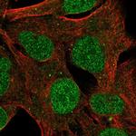 ZNF626 Antibody in Immunocytochemistry (ICC/IF)