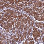 ZNF626 Antibody in Immunohistochemistry (IHC)