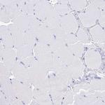 PATE4 Antibody in Immunohistochemistry (Paraffin) (IHC (P))