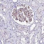 ADAMTSL2 Antibody in Immunohistochemistry (Paraffin) (IHC (P))