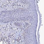 ADAMTSL2 Antibody in Immunohistochemistry (Paraffin) (IHC (P))