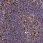 ADAMTSL2 Antibody in Immunohistochemistry (Paraffin) (IHC (P))
