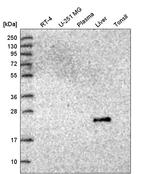 GGT2 Antibody in Western Blot (WB)