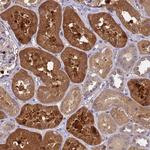 SLC35E2B Antibody in Immunohistochemistry (Paraffin) (IHC (P))