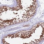 SPATA33 Polyclonal Antibody