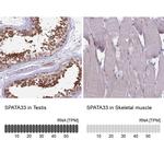 SPATA33 Antibody in Immunohistochemistry (IHC)