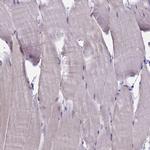 SPATA33 Antibody in Immunohistochemistry (IHC)