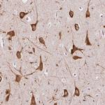 FMC1 Polyclonal Antibody