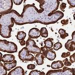 SREK1IP1 Polyclonal Antibody