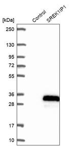SREK1IP1 Antibody in Western Blot (WB)