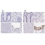 HDGFL1 Polyclonal Antibody
