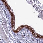 SLC25A37 Polyclonal Antibody