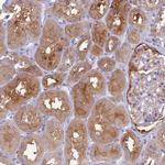 UBE2G1 Polyclonal Antibody