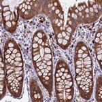 UBE2G1 Antibody in Immunohistochemistry (Paraffin) (IHC (P))