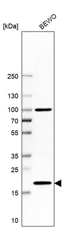 UBE2G1 Antibody in Western Blot (WB)