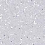 SSX2 Antibody in Immunohistochemistry (Paraffin) (IHC (P))