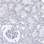 SSX2 Antibody in Immunohistochemistry (Paraffin) (IHC (P))