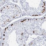 SSX2 Antibody in Immunohistochemistry (Paraffin) (IHC (P))