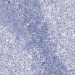 SSX2 Antibody in Immunohistochemistry (Paraffin) (IHC (P))