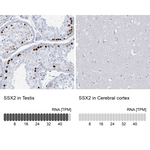 SSX2 Antibody in Immunohistochemistry (Paraffin) (IHC (P))