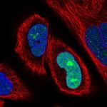 SSX2 Polyclonal Antibody